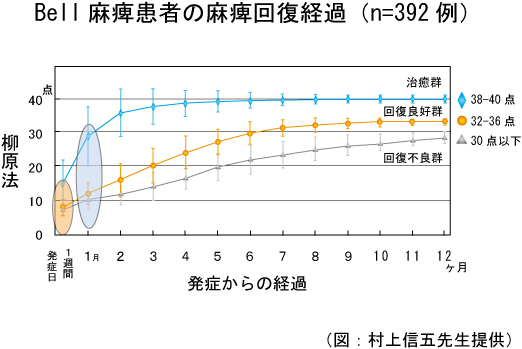 ベル麻痺