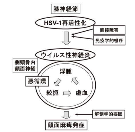 発症のメカニズム